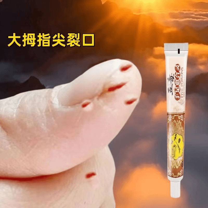 手指裂口干裂指尖大拇指开裂指甲边缘开裂手开裂手裂干裂粗糙修护