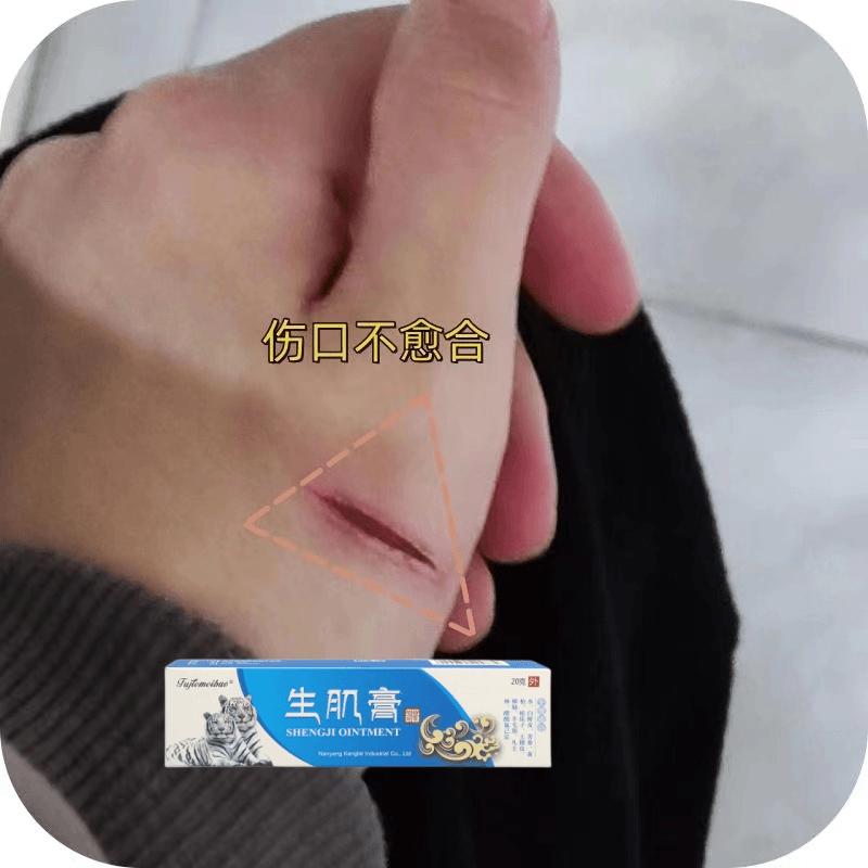 手部划伤伤口不愈合摔伤磕伤老烂腿生肌抑菌软膏