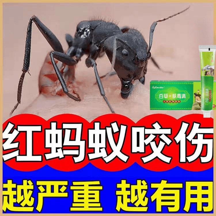 红火蚁软膏蚂蚁咬伤隐翅虫蚊虫跳蚤叮咬痒止痒消肿抑菌软膏